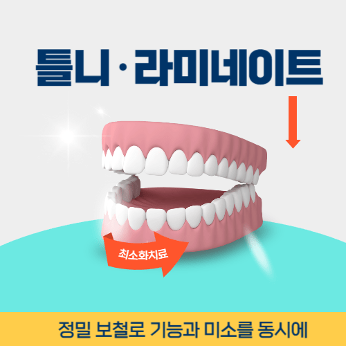 파주치과 파주시 치과 틀니 라미네이트