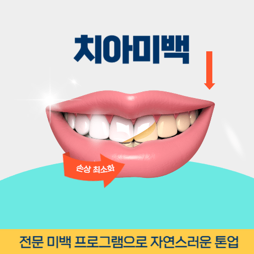 파주치과 파주시 치과 치아미백