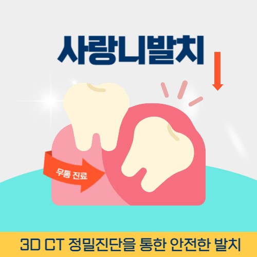 파주치과 파주시 치과 사랑니 발치