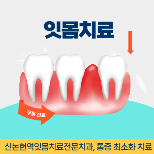 파주치과 파주시 치과 잇몸치료